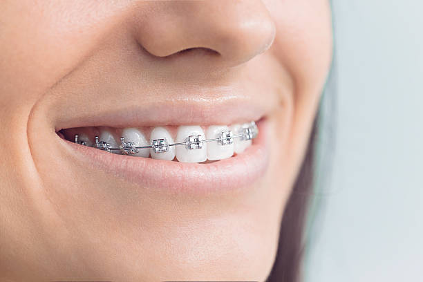 Best Teeth Whitening  in Jensen Beach, FL